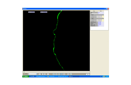 Settop Regression Axis